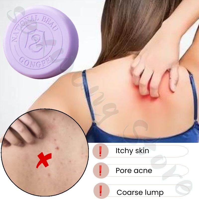 Salicylzuur perilla demodex ze - Salicylic Acid Blackhead Remover recensie en prijs