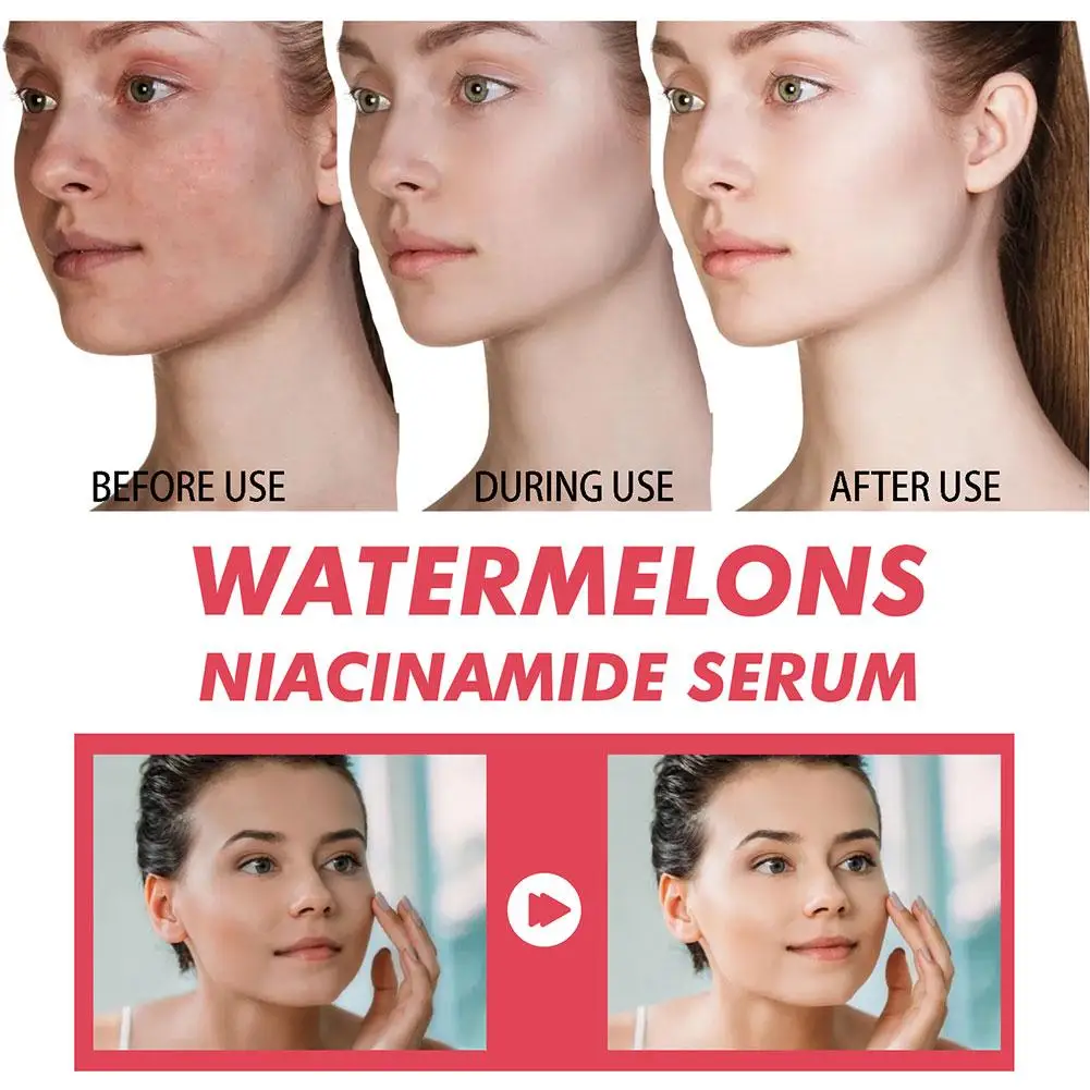 Watermeloen Glow Niacinamide H - Hyaluronic Acid Facial Serum recensie en prijs