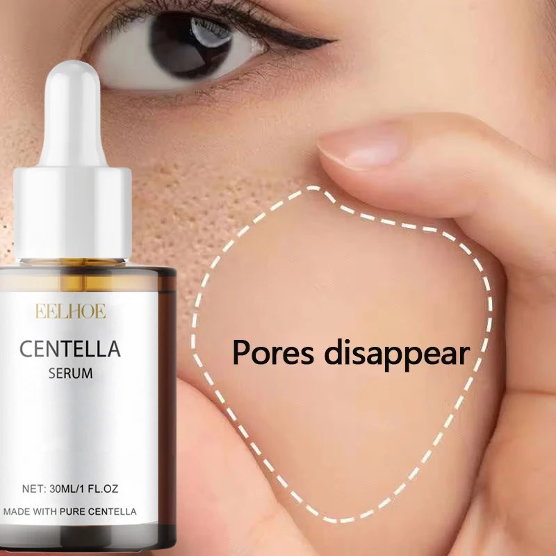 Centella Asiatica Gezicht Seru - Hyaluronic Acid Facial Serum recensie en prijs