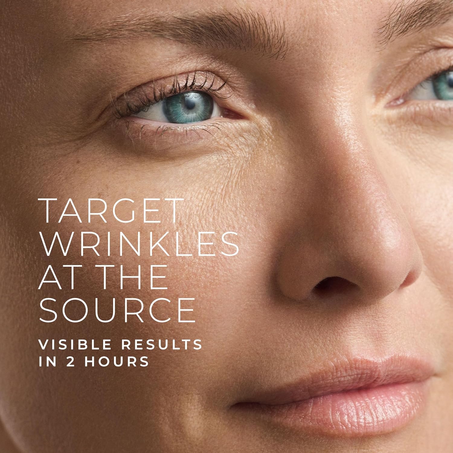 Hyaluronzuur Retinol Microneed - Skincare recensie en prijs